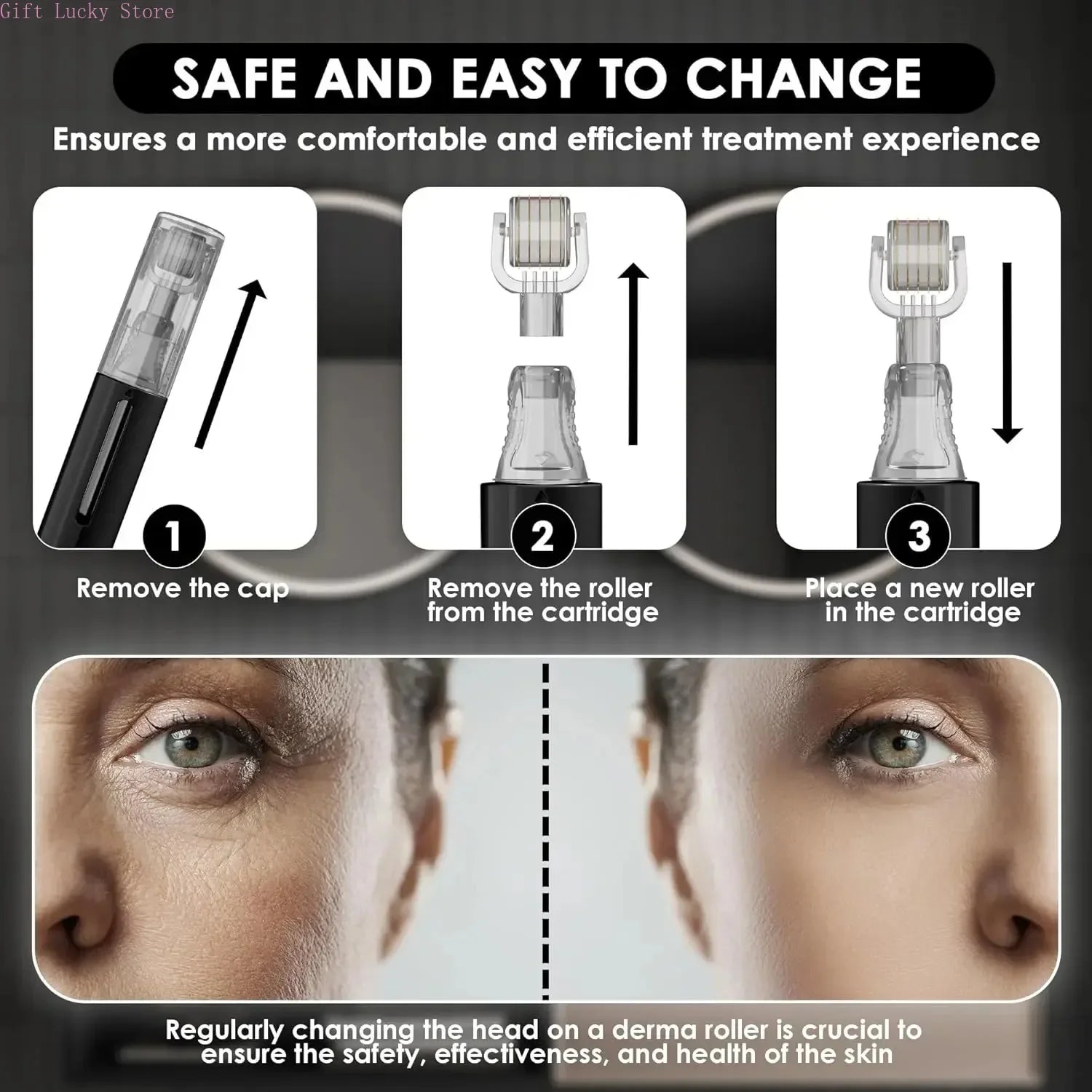 New Titanium Needle Roller,Lip Roller,Derma Roller,Beard Growth Roller,Beard Hair Growth Roller,Beard Treatment & Serum Applicat